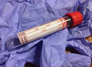 BỆNH TIỂU ĐƯỜNG