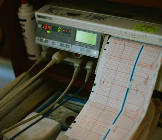 SIÊU ÂM TRONG ĐIỀU TRỊ THOÁI HÓA KHỚP